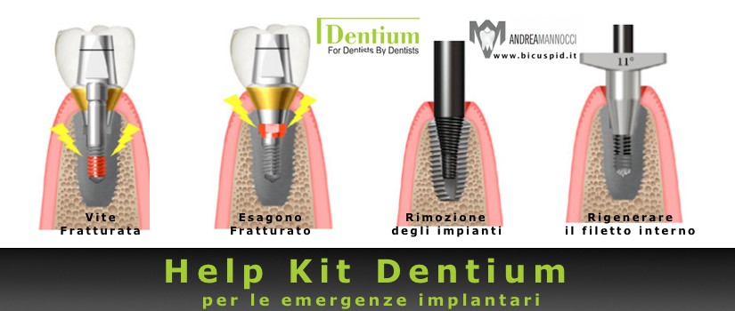 Help Kit Dentium , il kit per le emergenze implantari
