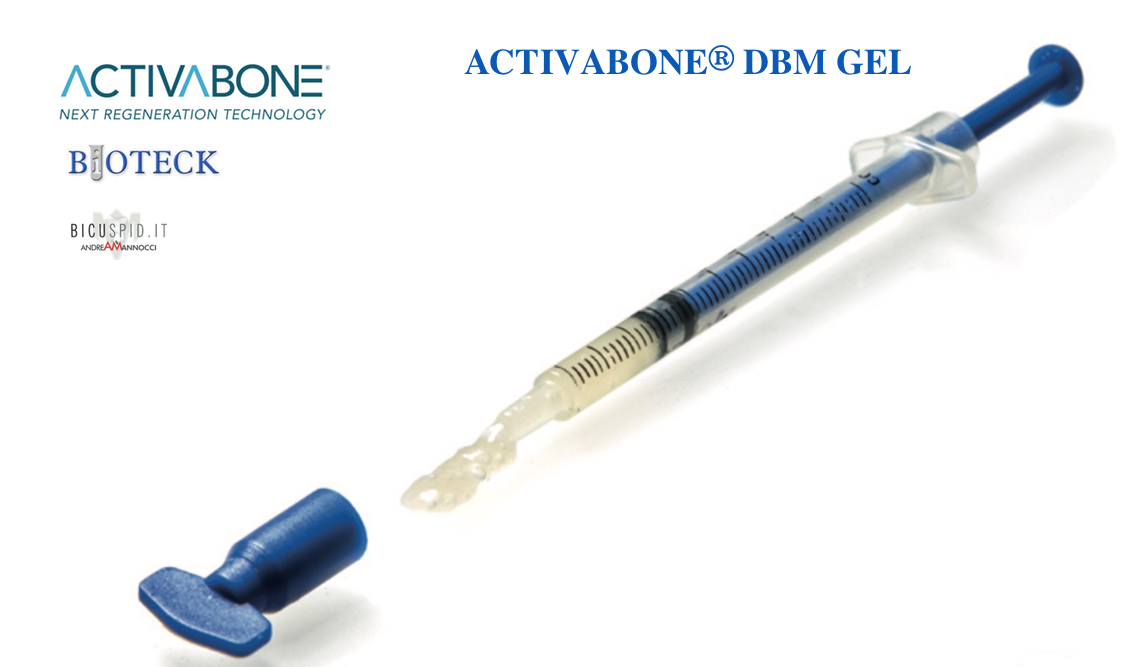 Bioteck Activabone in gel- con DBM fattori di crescita