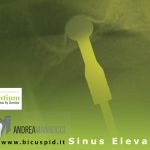 palloncino sinus elevator della dentium